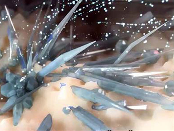 Hình ảnh những tinh thể urat