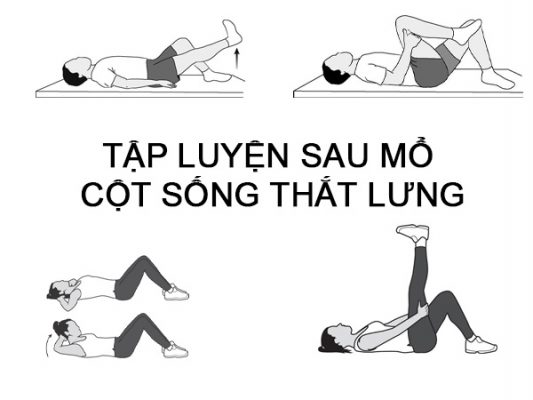 TẬP LUYỆN SAU MỔ CỘT SỐNG THẮT LƯNG