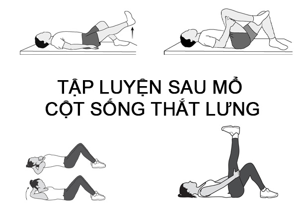 TẬP LUYỆN SAU MỔ CỘT SỐNG THẮT LƯNG