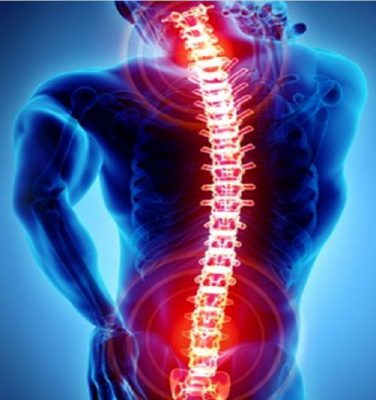 Biểu hiện bệnh lý lao cột sống