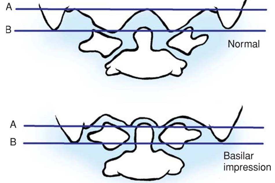 Đường Fischgold and Metzger [1]