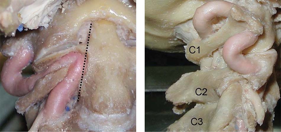 ĐMĐS đoạn qua cấu trúc C1 - C2