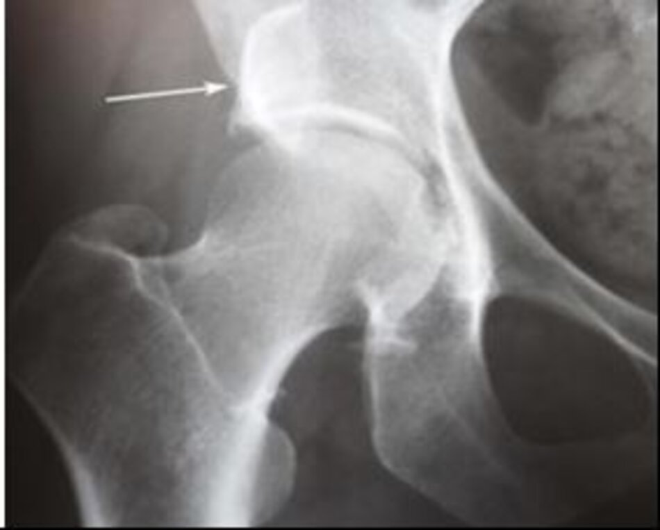 X quang trước mổ