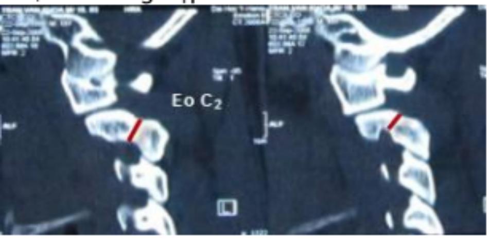 Mô tả kích thước eo C2