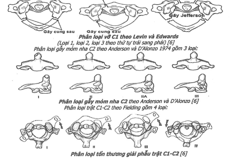 Phân loại tổn thương