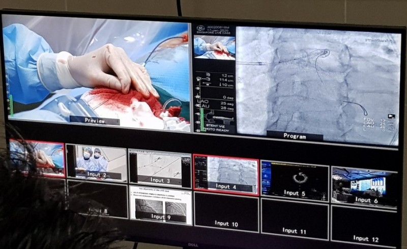 trinh dien truc tuyen 2 ca can thiep tim mach phuc tap