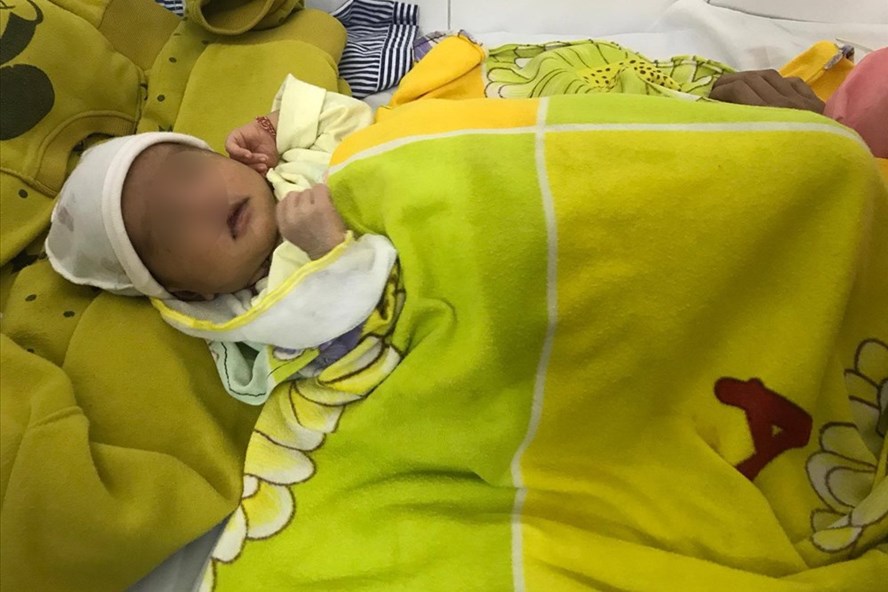 Bé Phương đang điều trị tại Bệnh viện Mắt Trung ương. Ảnh: TL