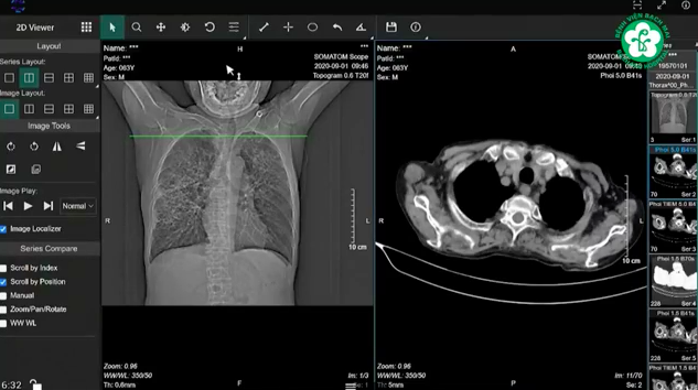 Khám chữa bệnh từ xa: Hành trình “giành giật” hơi thở cho nam bệnh nhân 6 lần tim ngừng đập - Ảnh 3.