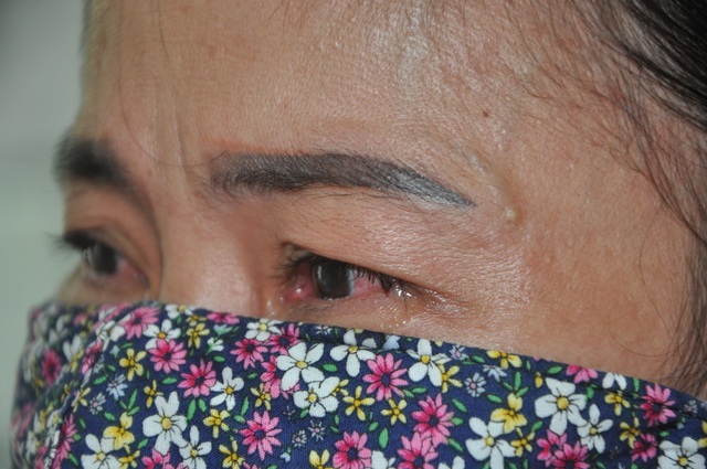 Thương người mẹ goá đôi mắt đỏ hoe cầu xin bạn đọc cứu con - 2