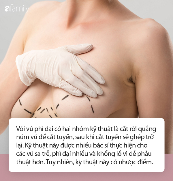 Người phụ nữ xinh đẹp bỗng hóa xồ xề, ngực chảy đến rốn sau 2 lần sinh nở bởi chứng bệnh nghe xong chỉ chực khóc hết nước mắt - Ảnh 4.